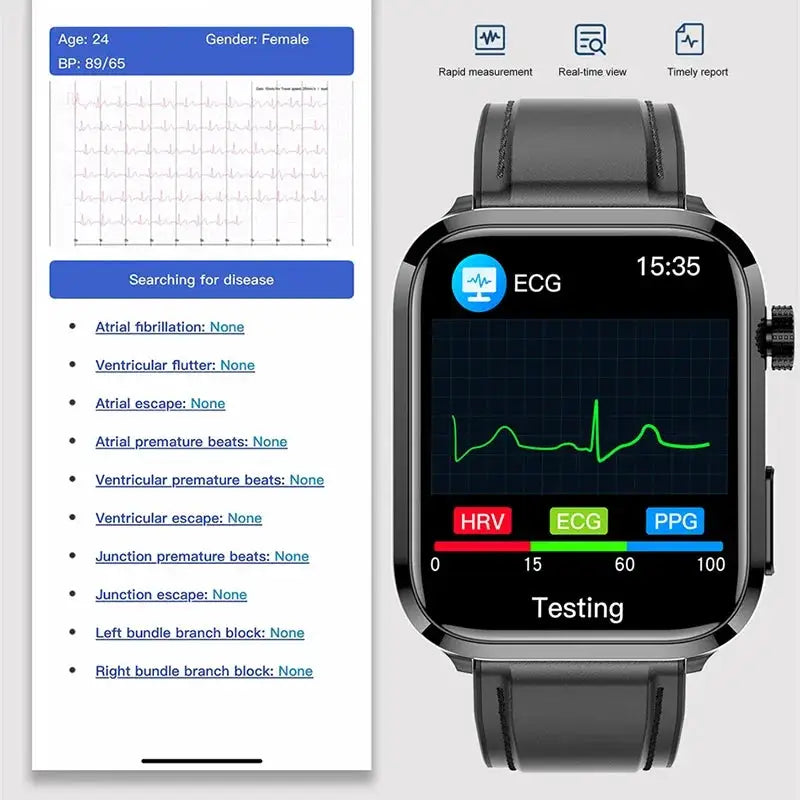 HEALTHCARE PLUS® - LIPIDS URIC ACID BLOOD GLUCOSE MONITORING SMART WATCH - ECG+PPG FITNESS TRACKER